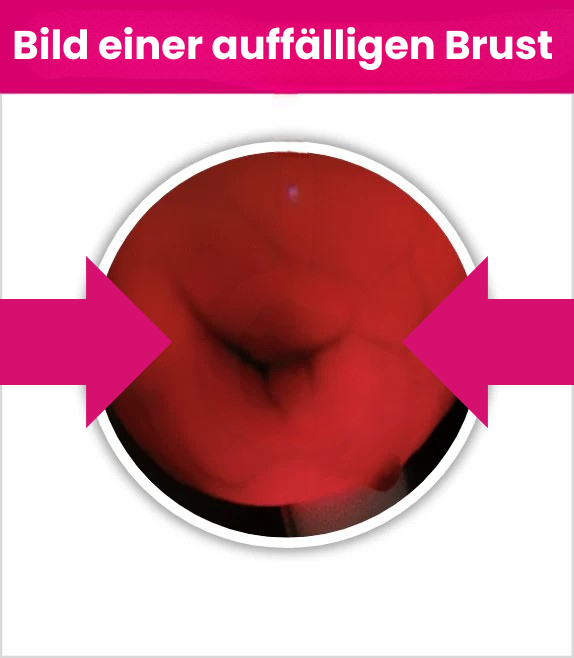 Brust_not_ok.png__PID:159e7a54-b6bb-45cc-83db-1b2a33891678