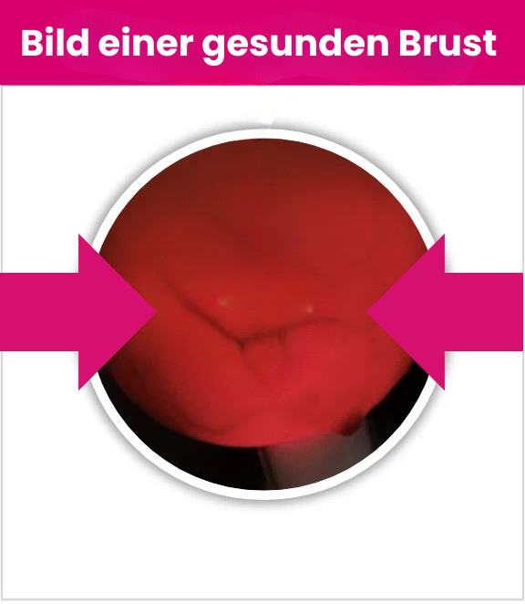 Brust_ok.png__PID:6529f89b-5335-48b3-b955-b10f2bb79231